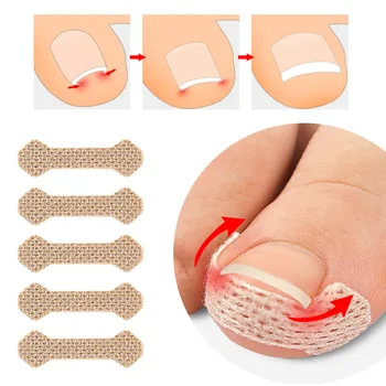 40/100pcs стикери за корекция на ноктите Врастнали коректори за нокти на краката Лечение Възстановяване на коректор Инструмент за грижа за педикюра